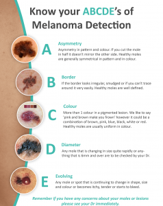 How to check your moles and freckles for melanoma - Work Health ...